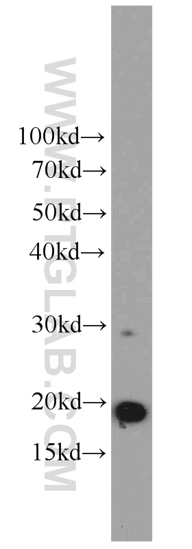 10403-1-AP;A2780 cells