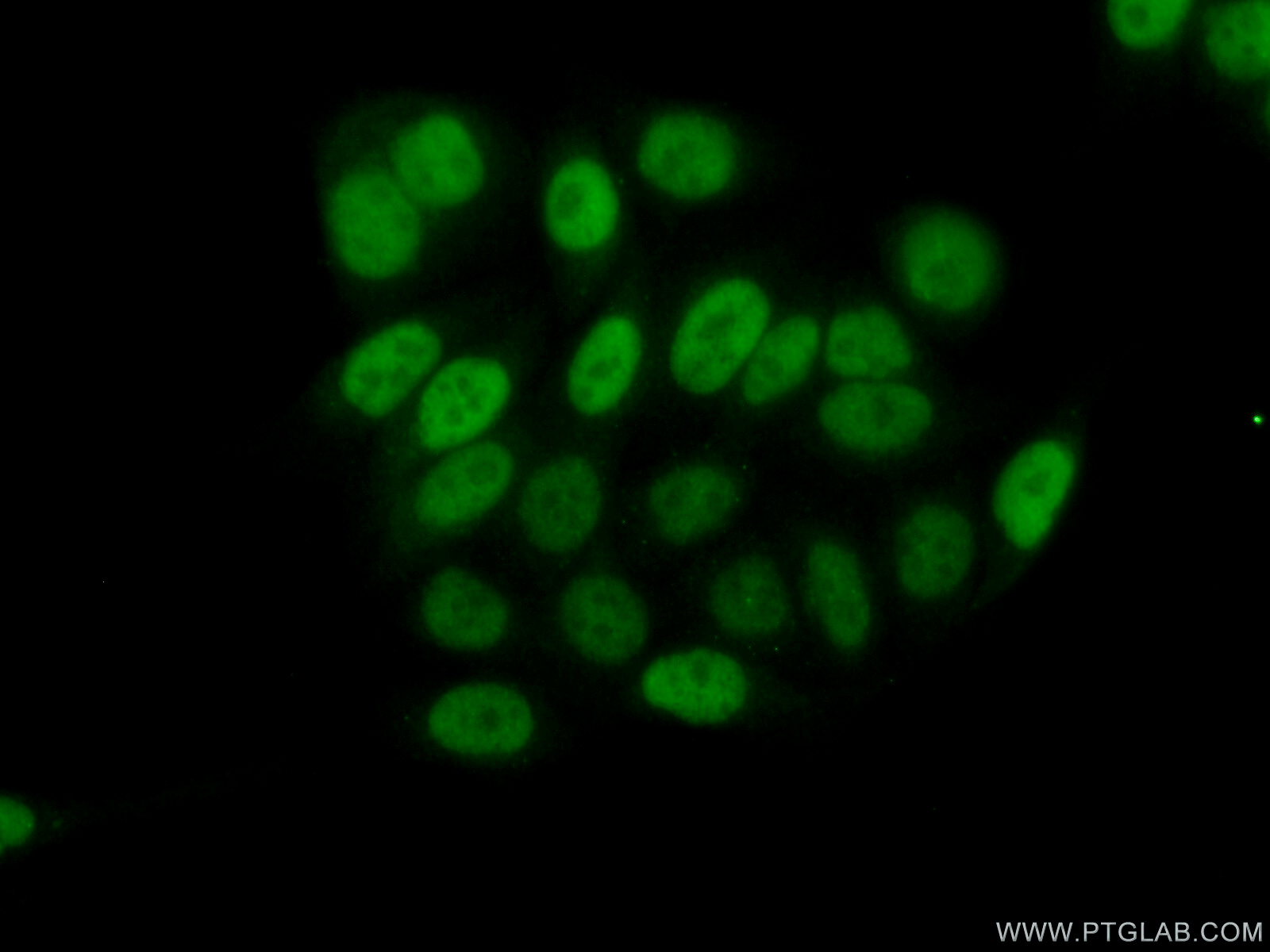 18475-1-AP;PC-3 cells