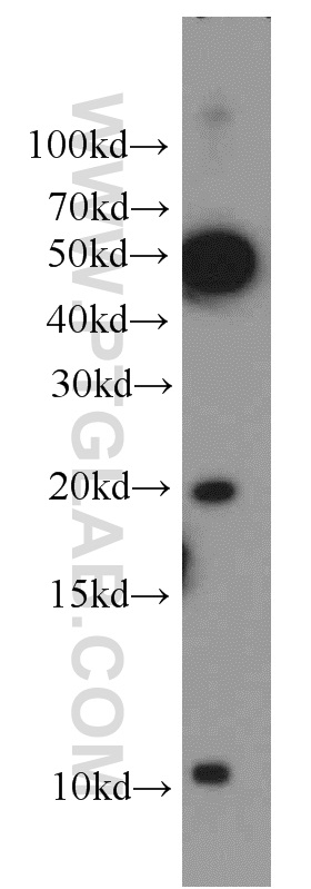 18475-1-AP;PC-3 cells