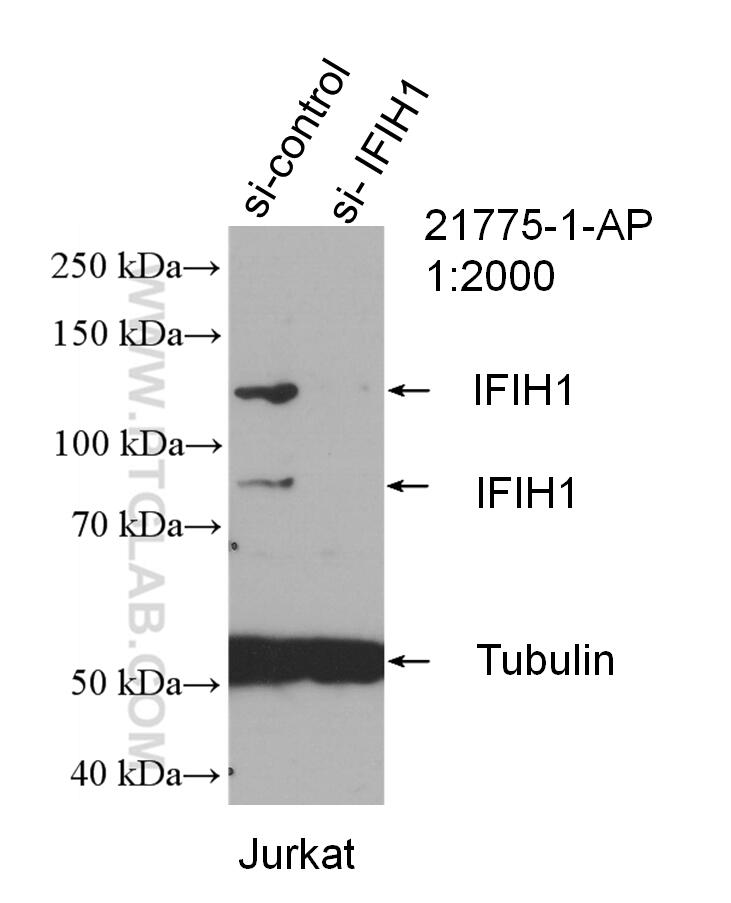 ifih1-mda5-antibody-21775-1-ap-proteintech