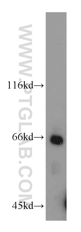 10522-1-AP;MCF7 cell