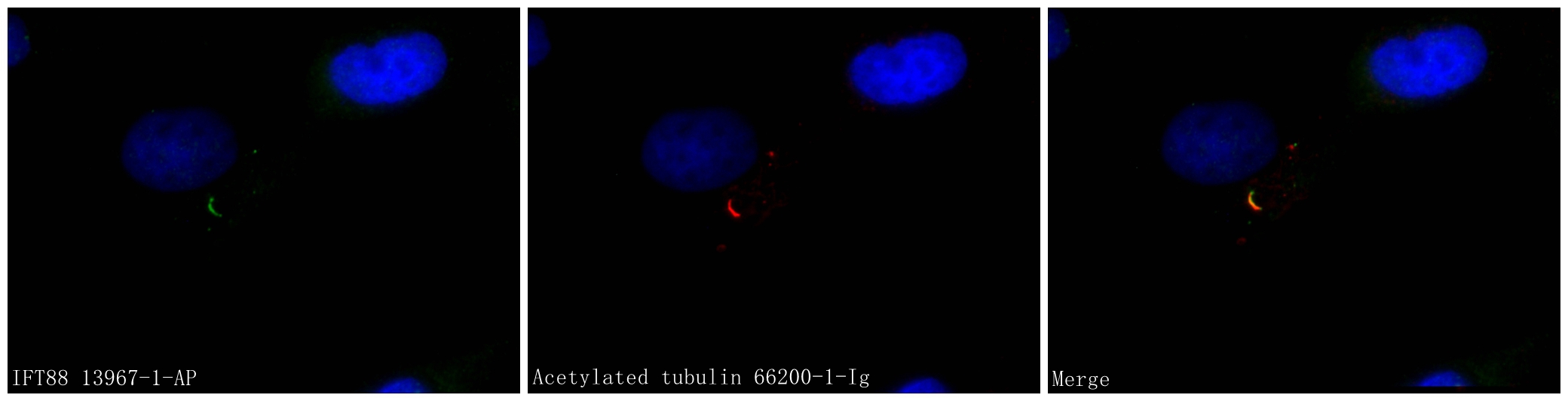 IFT88 Antibody 13967 1 AP Proteintech ift88-antibody-13967-1-ap-proteintech