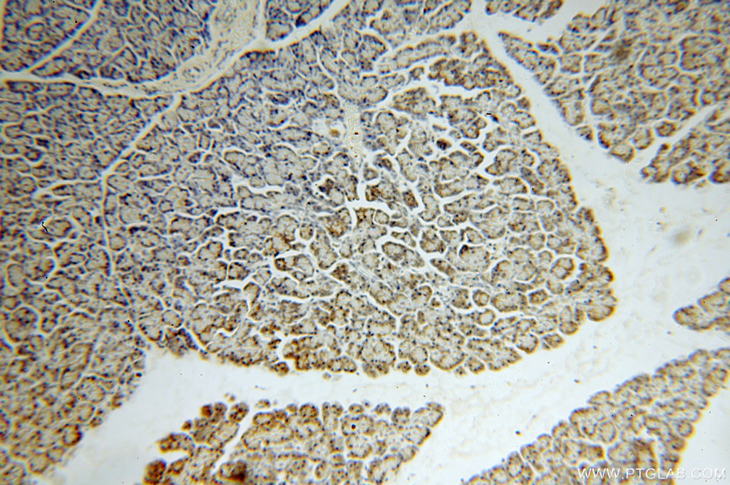 IFT88 Antibody 13967 1 AP Proteintech ift88-antibody-13967-1-ap-proteintech