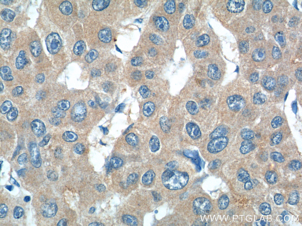 24165-1-AP;human liver cancer tissue