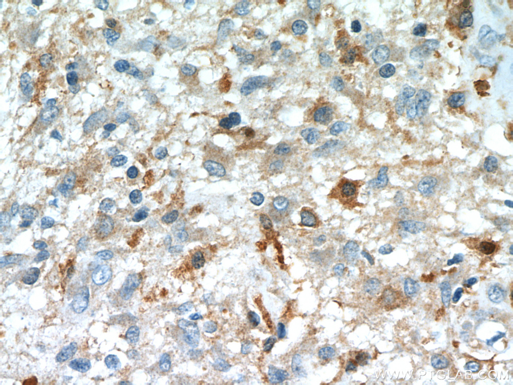 IL13RA2 Antibody 110591AP Proteintech