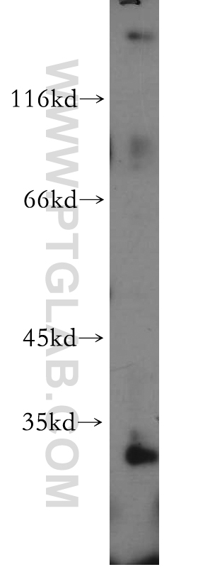 20673-1-AP;human testis tissue