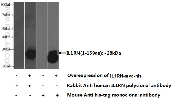 10844-1-AP;Transfected HEK-293 cells