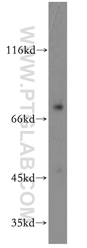 13602-1-AP;HEK-293 cell