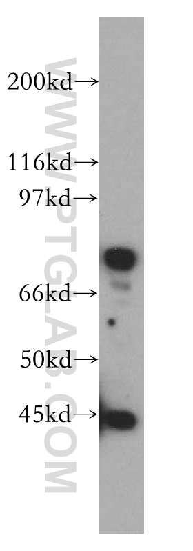 12655-1-AP;Jurkat cells