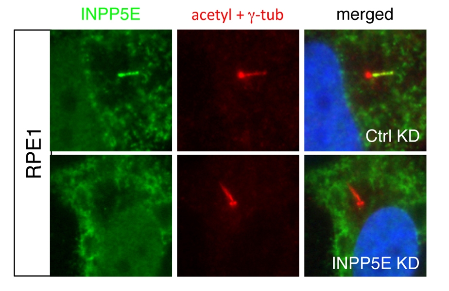 INPP5E Antibody 177971AP Proteintech