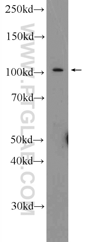 23829-1-AP;mouse lung tissue