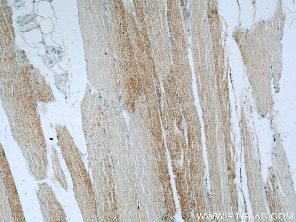 23239-1-AP;human skeletal muscle tissue