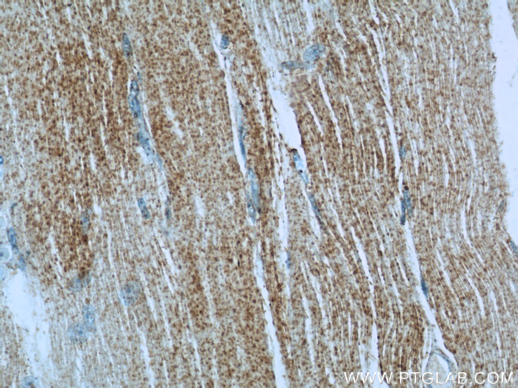 23239-1-AP;human skeletal muscle tissue