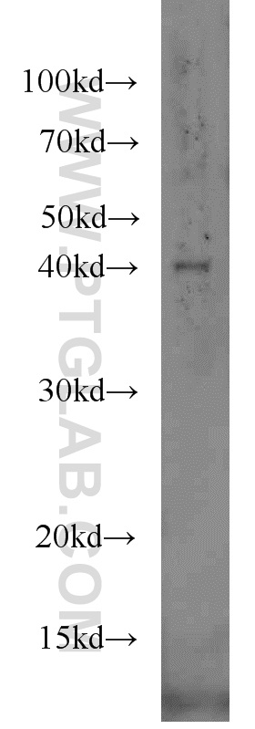 10822-1-AP;MCF7 cells