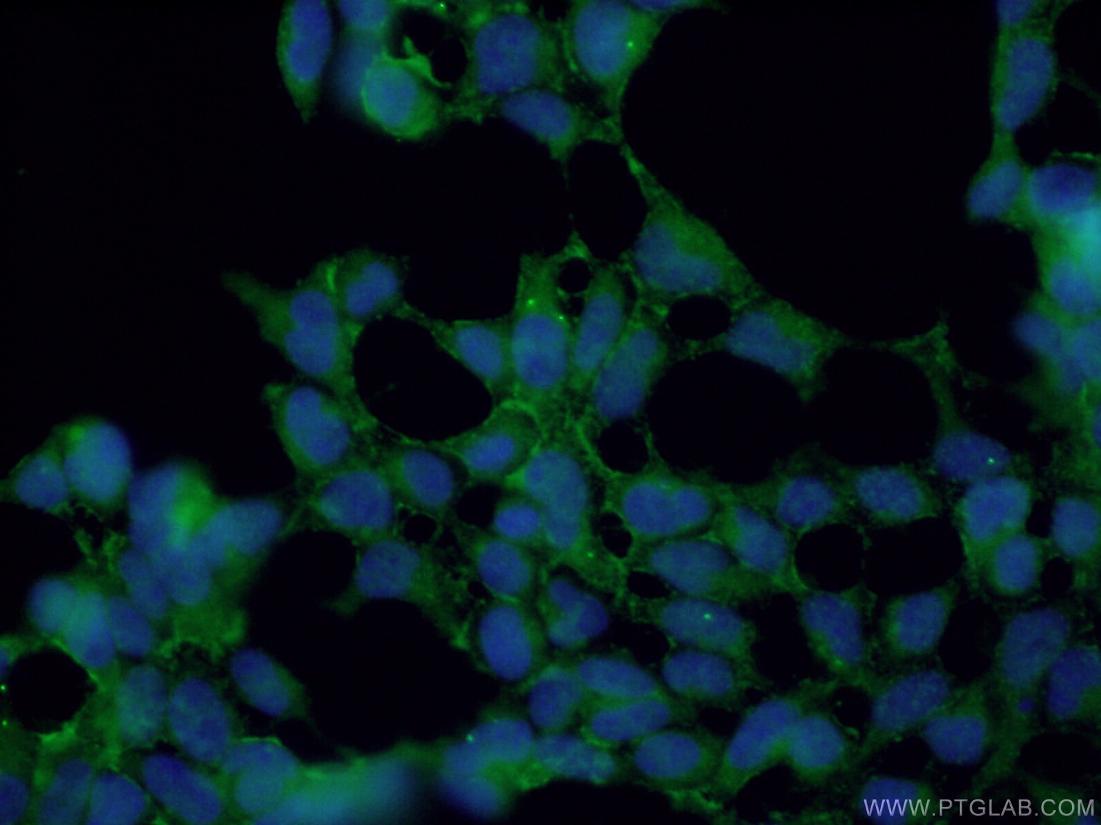 KCNN4 Antibody 232711AP Proteintech
