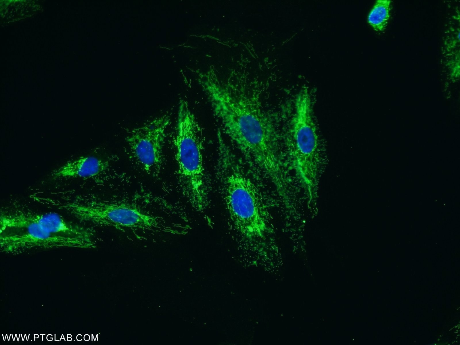 25419-1-AP;A549 cells