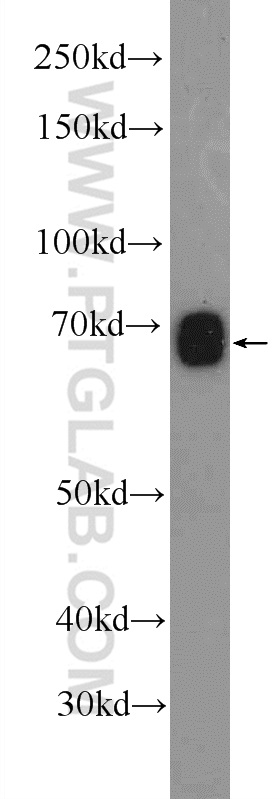 25419-1-AP;mouse liver tissue