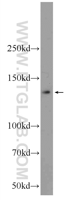 51101-1-AP;HeLa cells