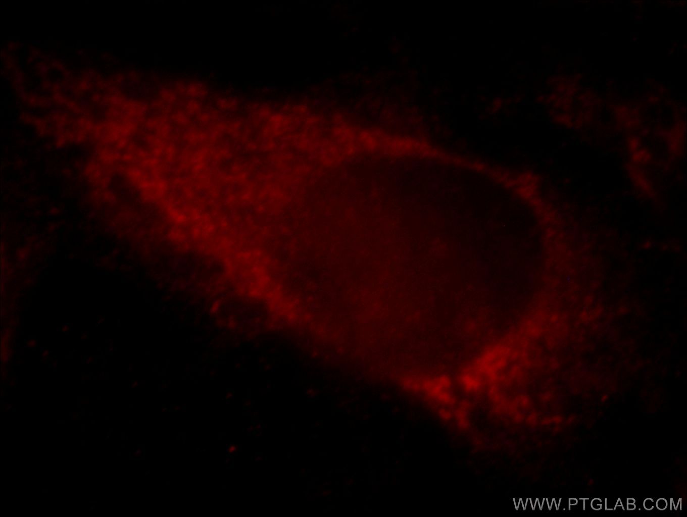 20637-1-AP;Hela