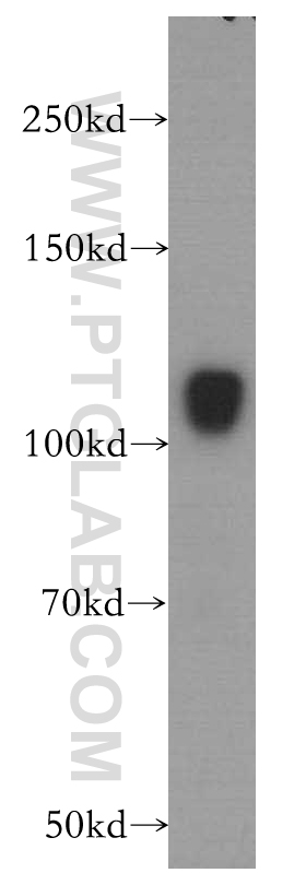18993-1-AP;human brain tissue
