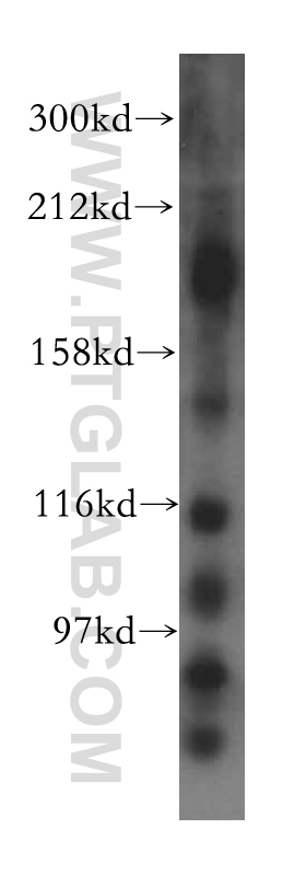 14615-1-AP;mouse brain tissue