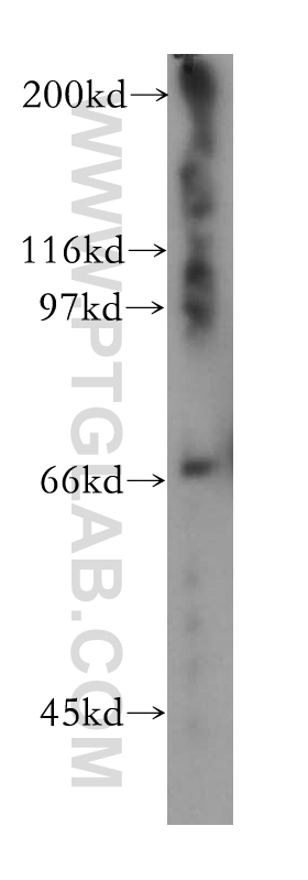 13403-1-AP;human heart tissue
