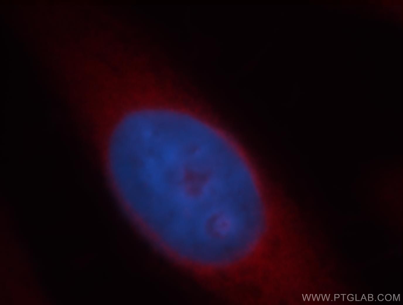 19028-1-AP;Hela