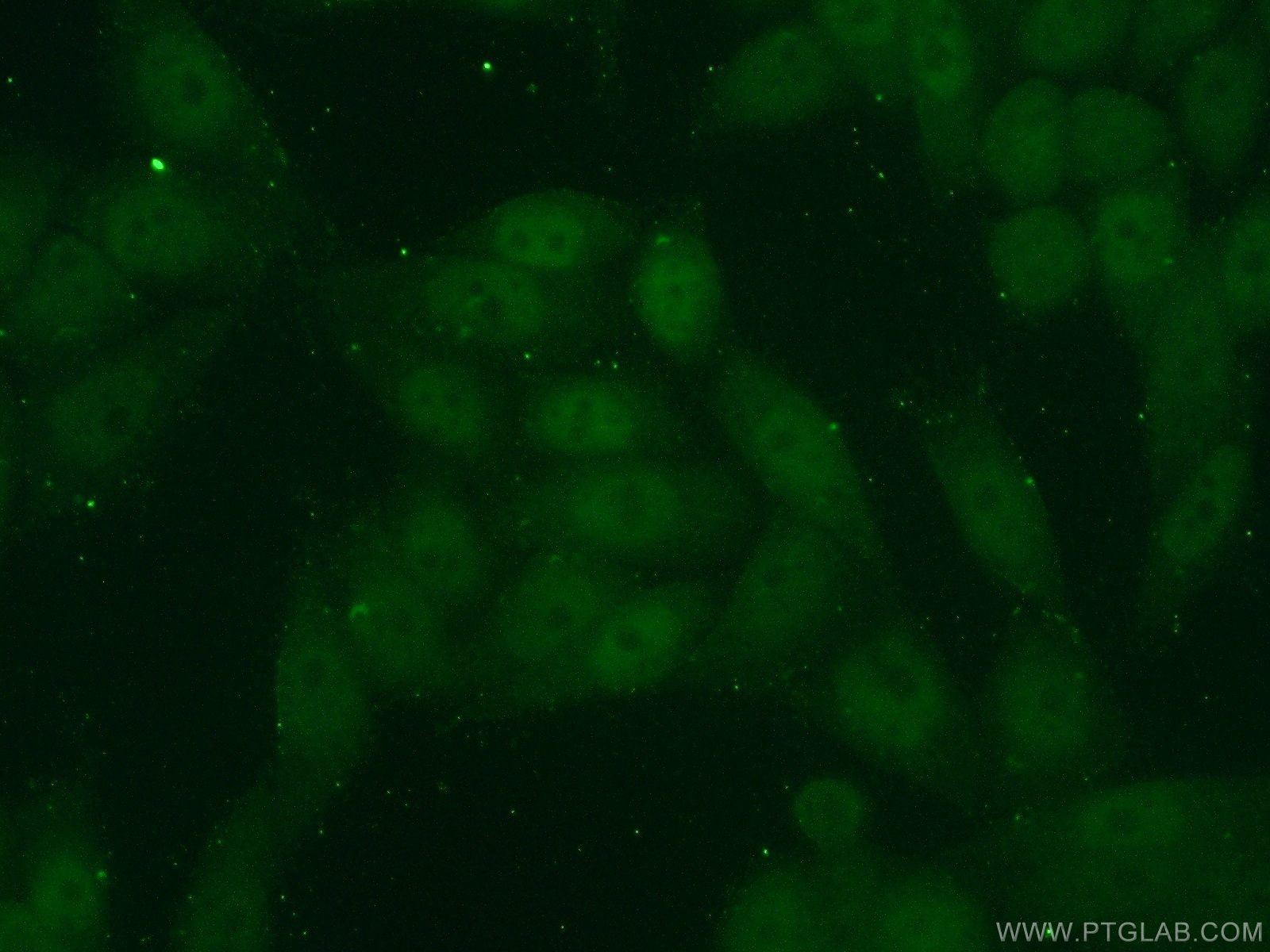 21017-1-AP;HeLa cells