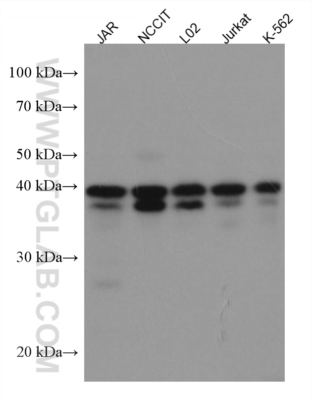 KLF6 Antibody 672971Ig Proteintech