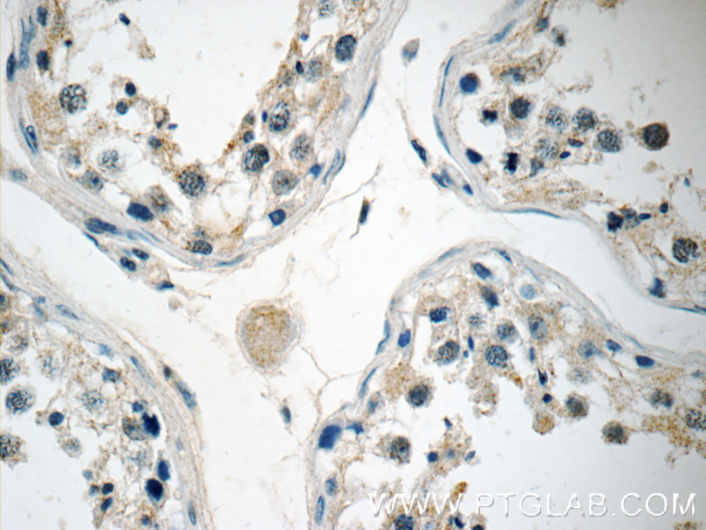 13905-1-AP;human testis tissue