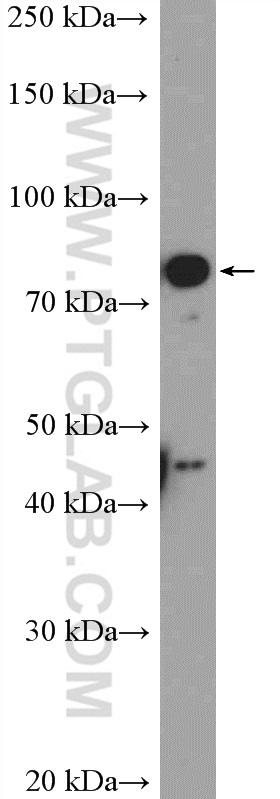 17117-1-AP;COLO 320 cells