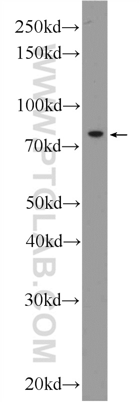 55394-1-AP;HeLa cells