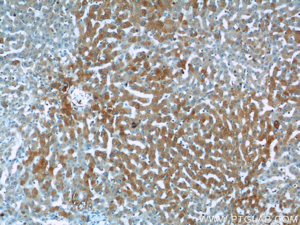 24409-1-AP;human liver tissue