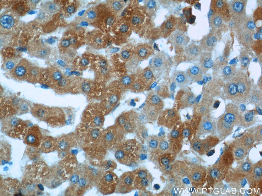 24409-1-AP;human liver tissue