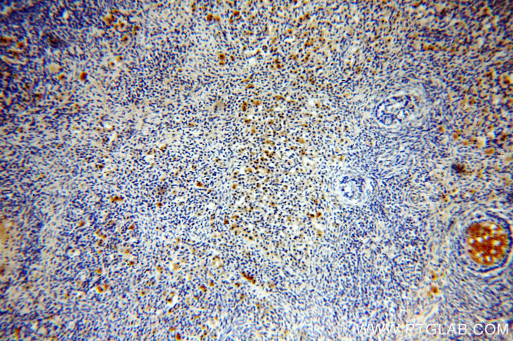 19841-1-AP;H-ovary
