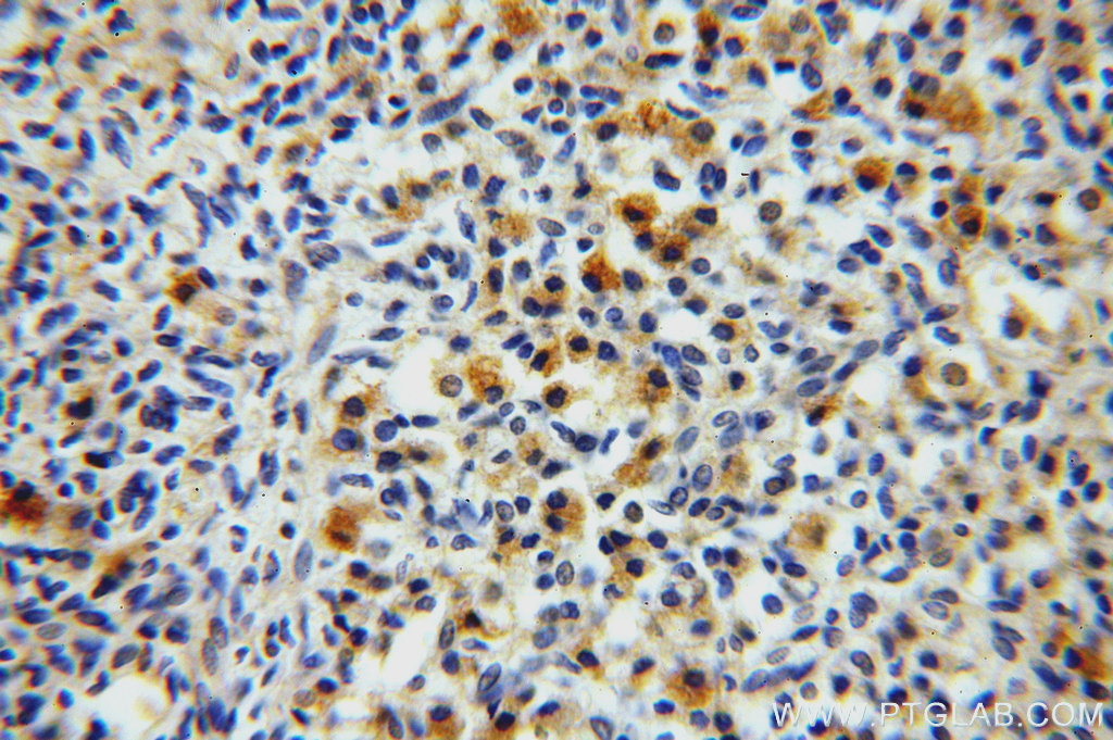 19841-1-AP;H-ovary