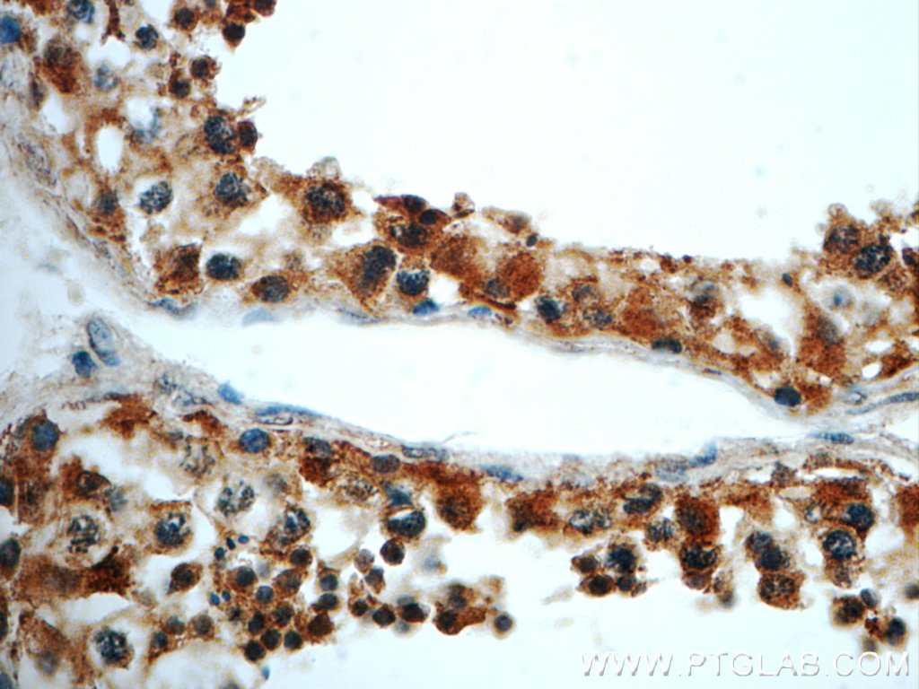 22441-1-AP;human testis