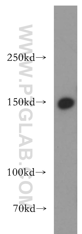 13708-1-AP;HeLa cell