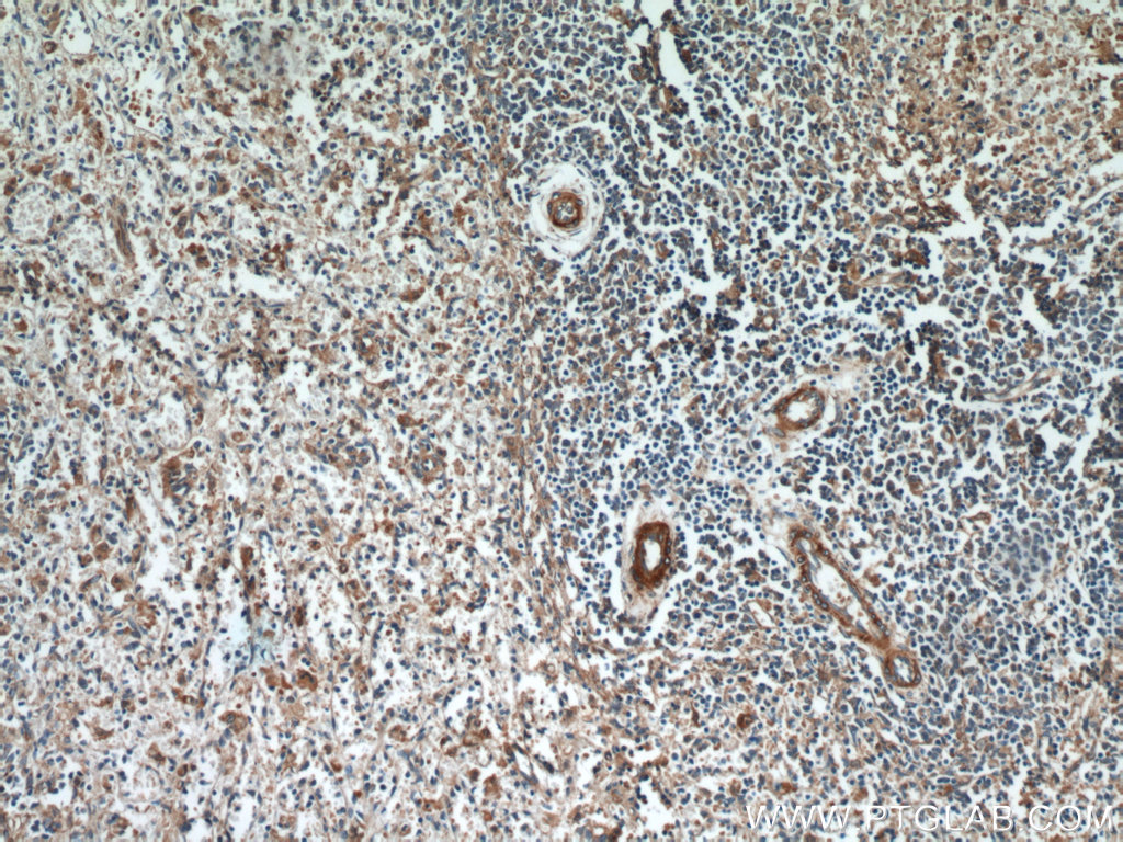 21557-1-AP;human spleen tissue