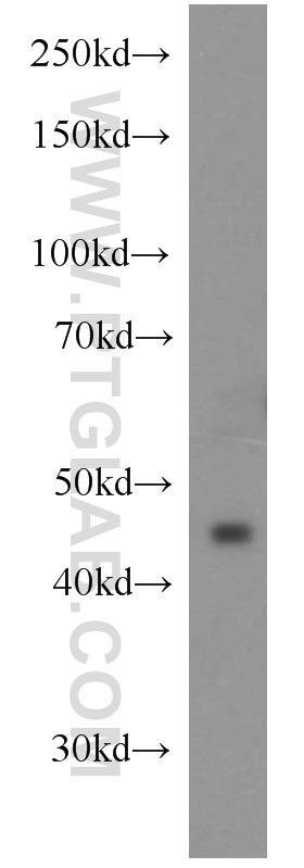 21557-1-AP;HeLa cell