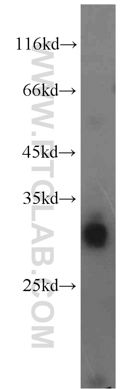 16221-1-AP;mouse liver tissue