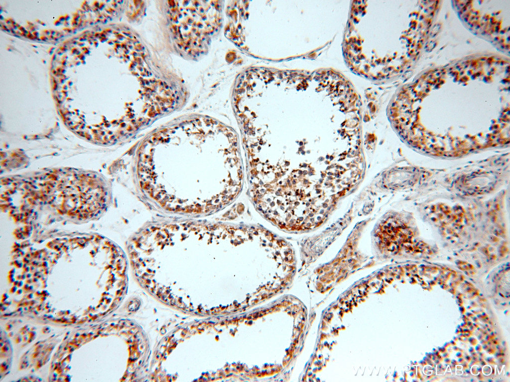 19989-1-AP;human testis