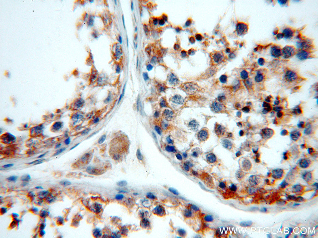 19989-1-AP;human testis