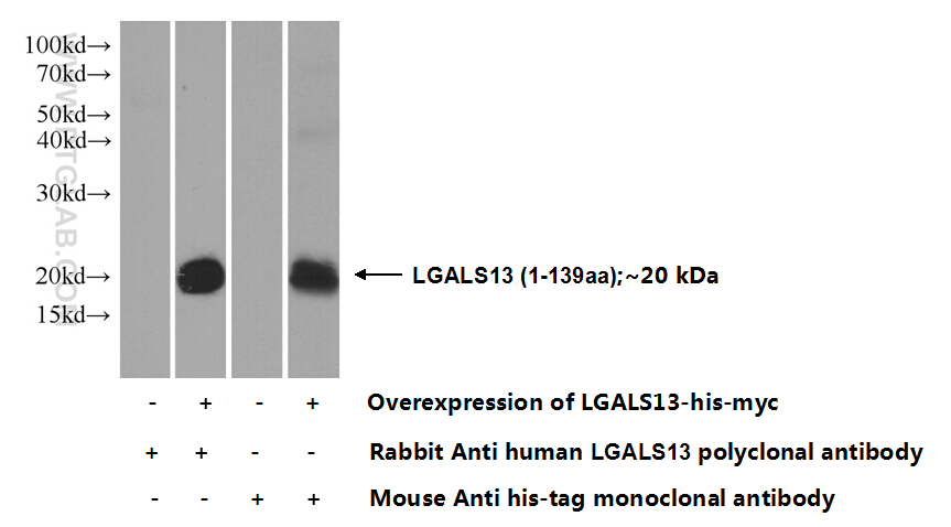 17823-1-AP;Transfected HEK-293 cells