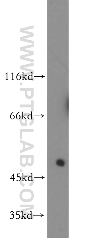 11461-1-AP;human liver tissue