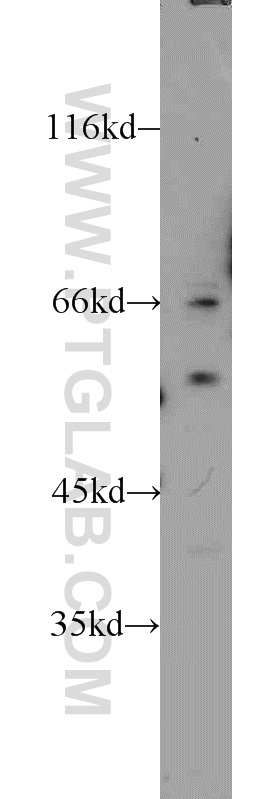 ERGIC53 Antibody 133641AP Proteintech
