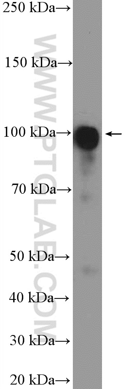 18035-1-AP;Jurkat cells