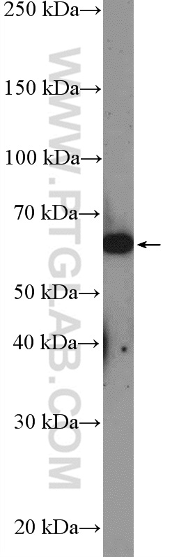 26608-1-AP;MCF-7 cells