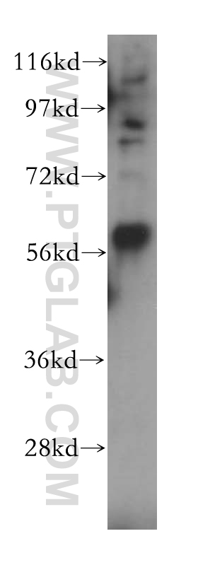 17905-1-AP;mouse brain tissue