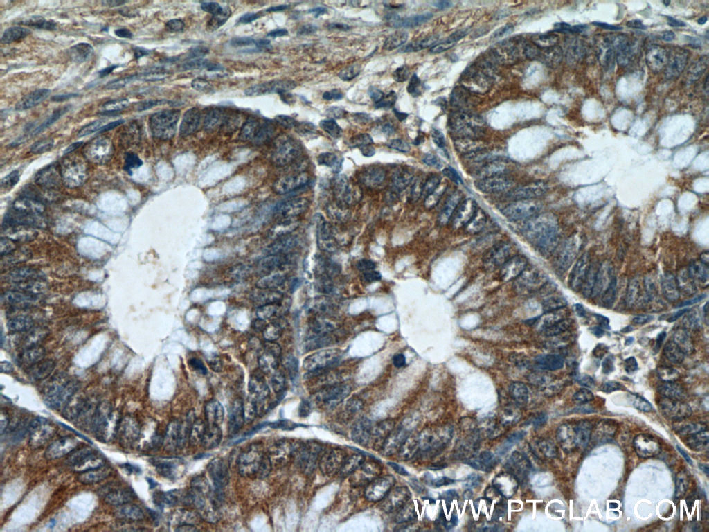 24866-1-AP;human colon tissue